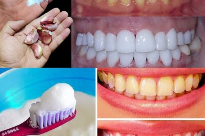 The Secret to Whitening Teeth in Just 2 Minutes! Shiny, Pearly Teeth with Garlic & Baking Soda – Natural and Effective!